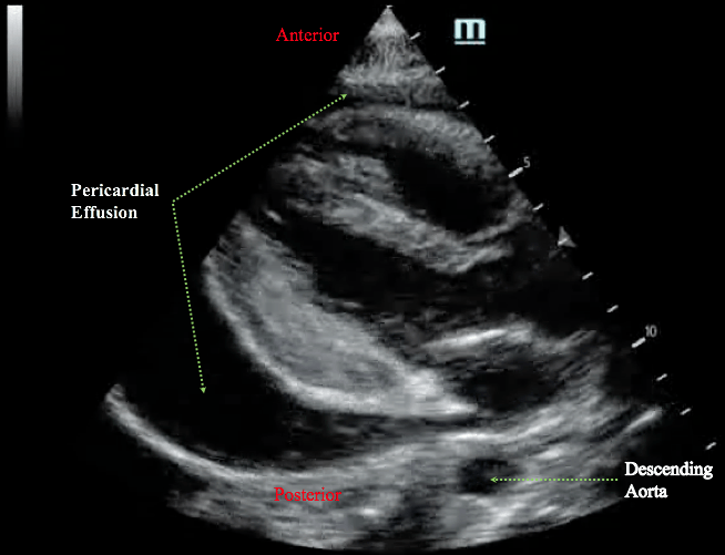 Internal Medicine Point Of Care Ultrasound Impocus